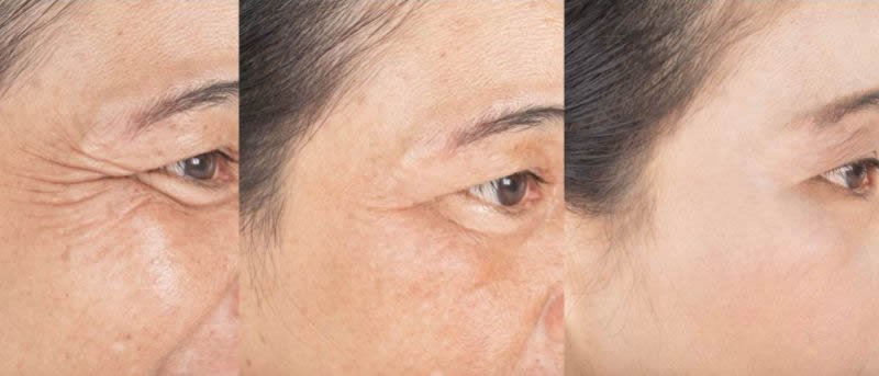 Harmonizacao Facial com a Dra. Thais Teles Referencia em Brasilia